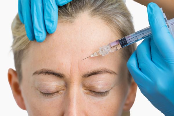 Botox Migraine Injections